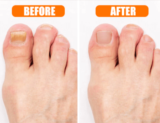 Hewelth BioClear Nails Benefits